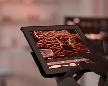 Smart Cameras for PPE Kit Detection